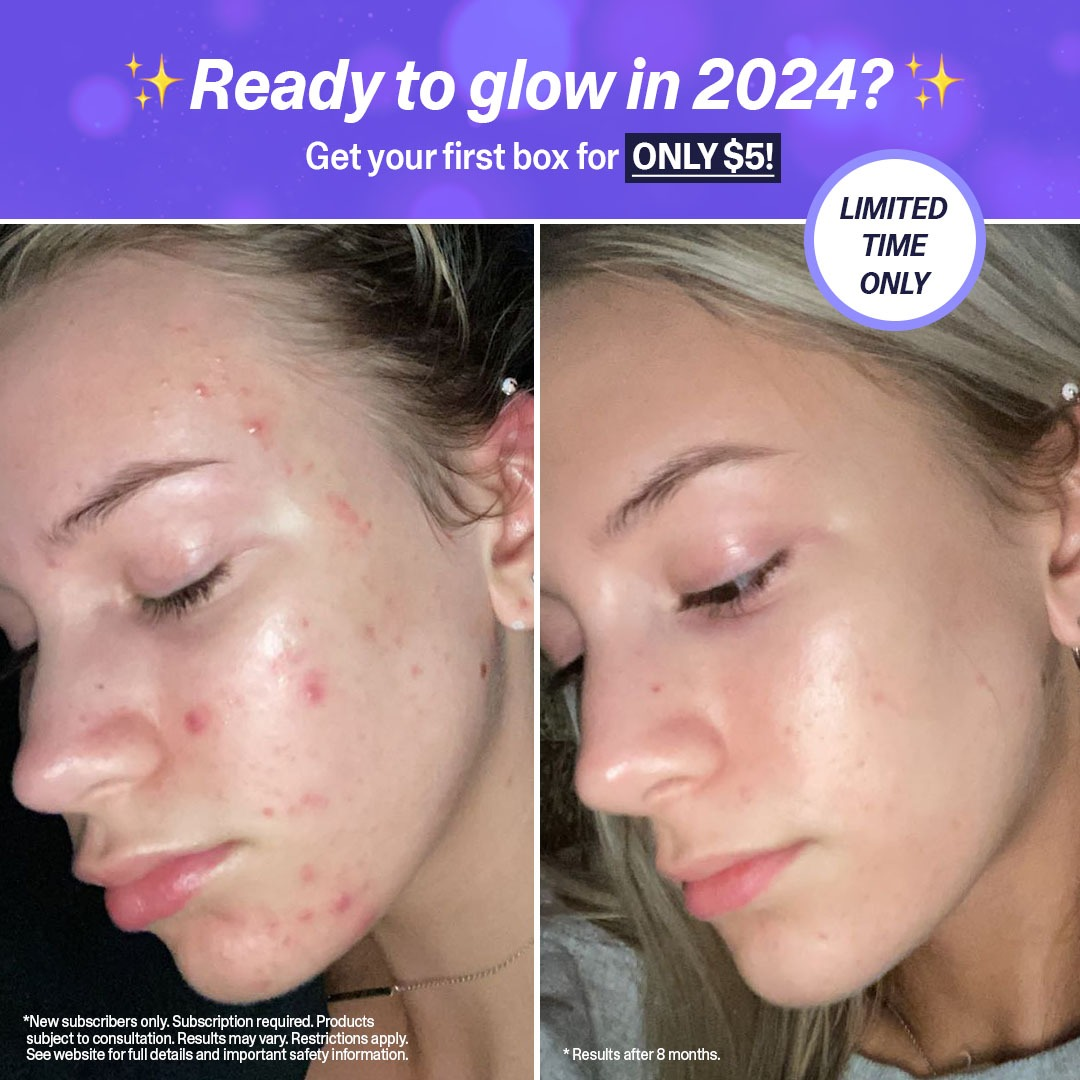 Before/After Ad Breakdown: Selfie-Style Skincare — Before/After Meta ad example for Skincare