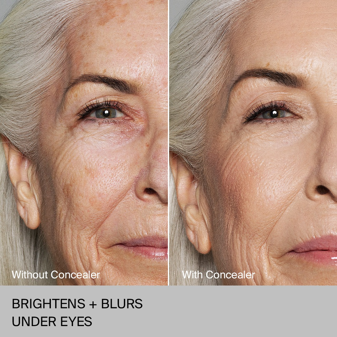 Before/After Ad Breakdown for Skincare — Before/After Meta ad example for Skincare