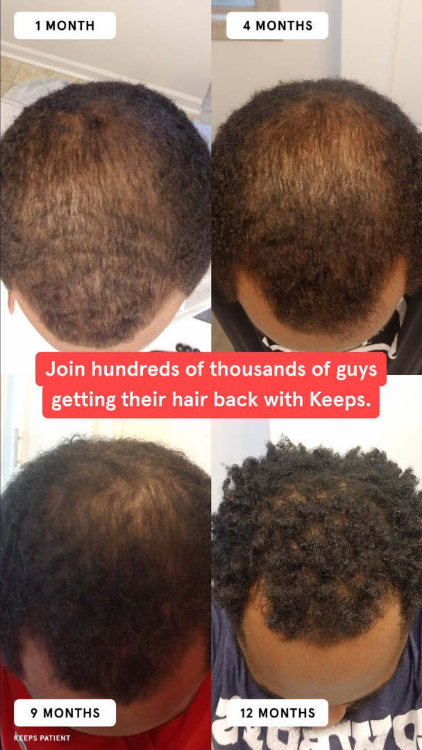 Before/After Ad Breakdown for Hair Loss Treatment — Before/After Meta ad example for Health & Wellness